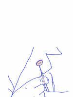 Especialista Blanqueamiento dental en Madrid