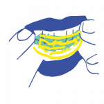 BLANQUEAMIENTO CLINICO