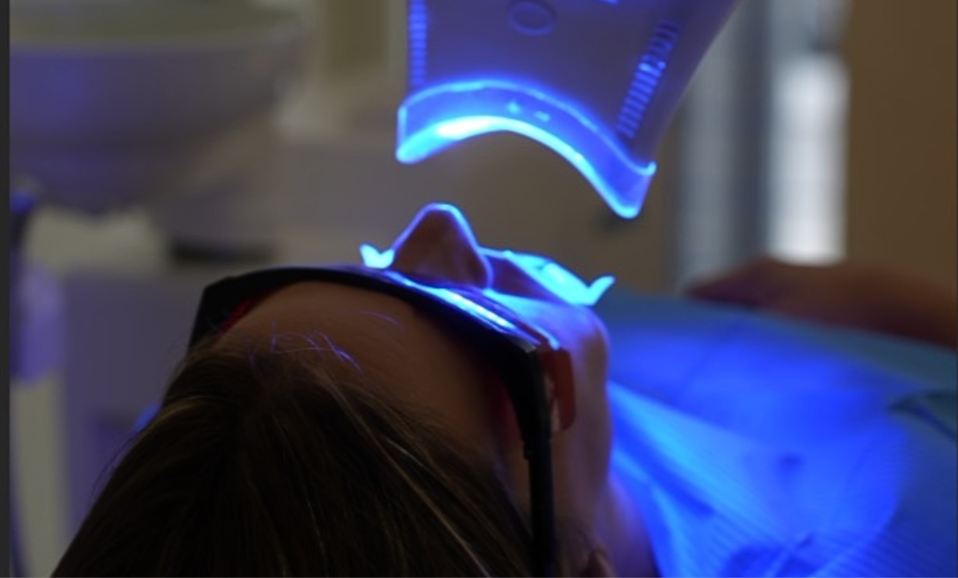 Blanqueamiento dental madrid